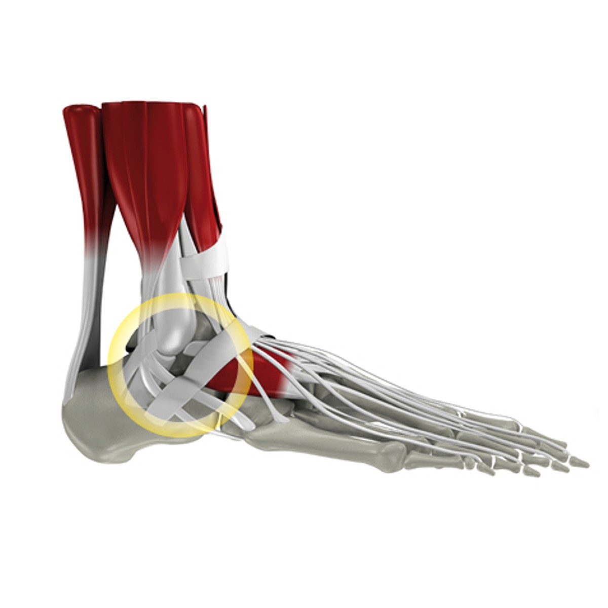 Sprunggelenksverletzungen